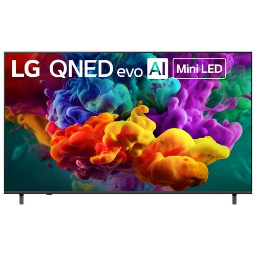 $